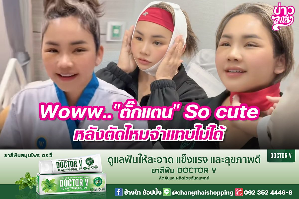 Woww.. "ตั๊กแตน" So cute หลังตัดไหมจำแทบไม่ได้