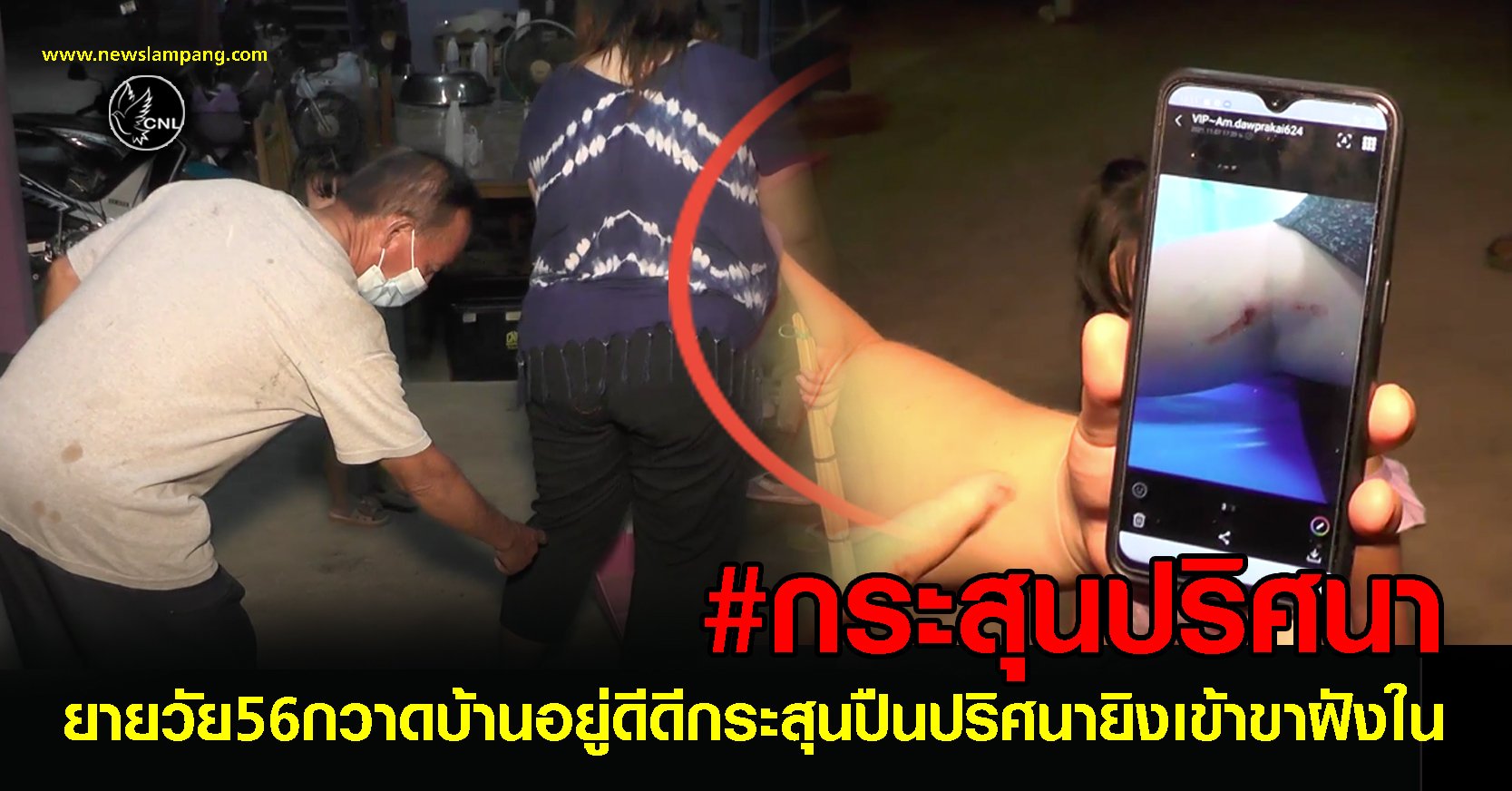 ยายวัย56กวาดบ้านอยู่ดีดี-กระสุนปริศนายิงเข้าขาฝังใน-คาดฝีมือเพื่อนบ้านที่ชอบยิงนก