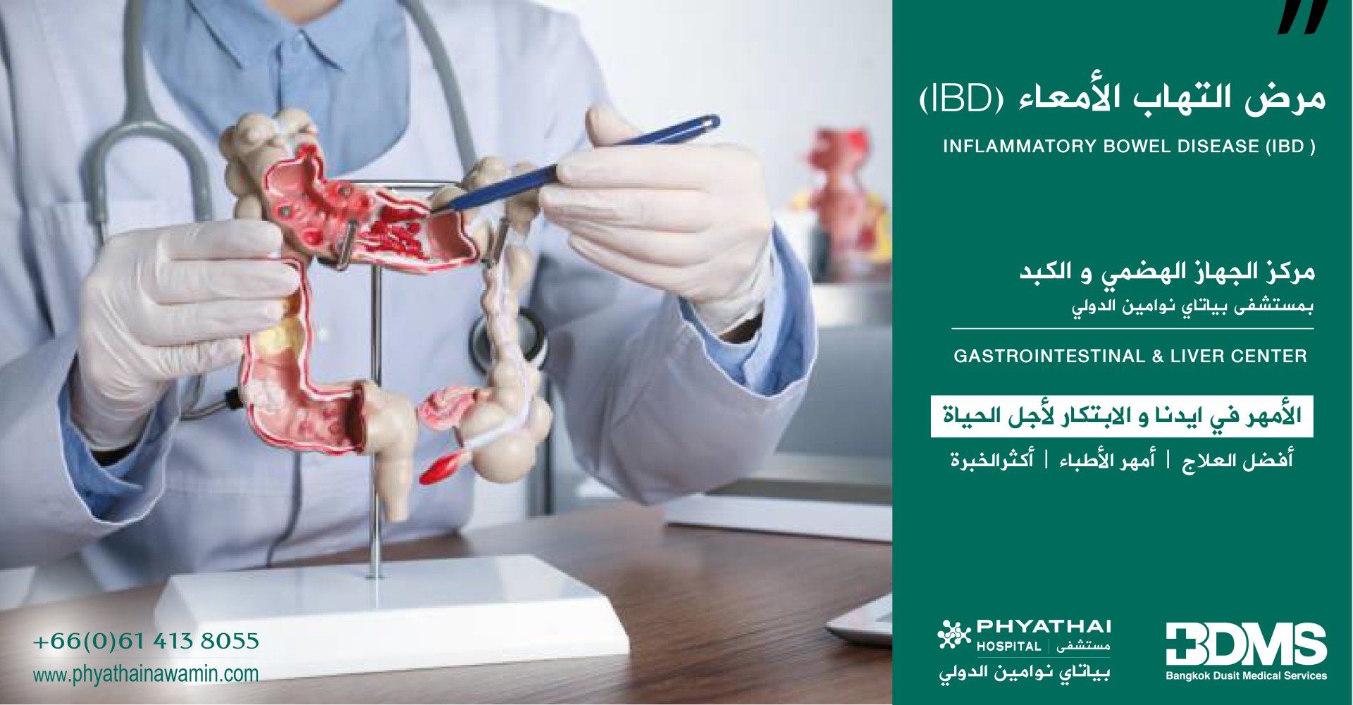 مرض التهاب الأمعاء (IBD)