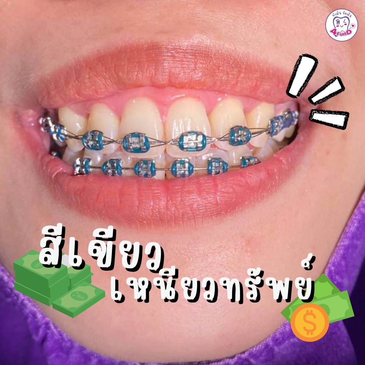 Review สียางจัดฟัน - 4Fundclinic