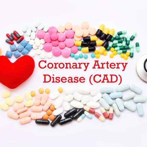 การรักษาโรคหลอดเลือดหัวใจ การรักษาโรคหลอดเลือดหัวใจ