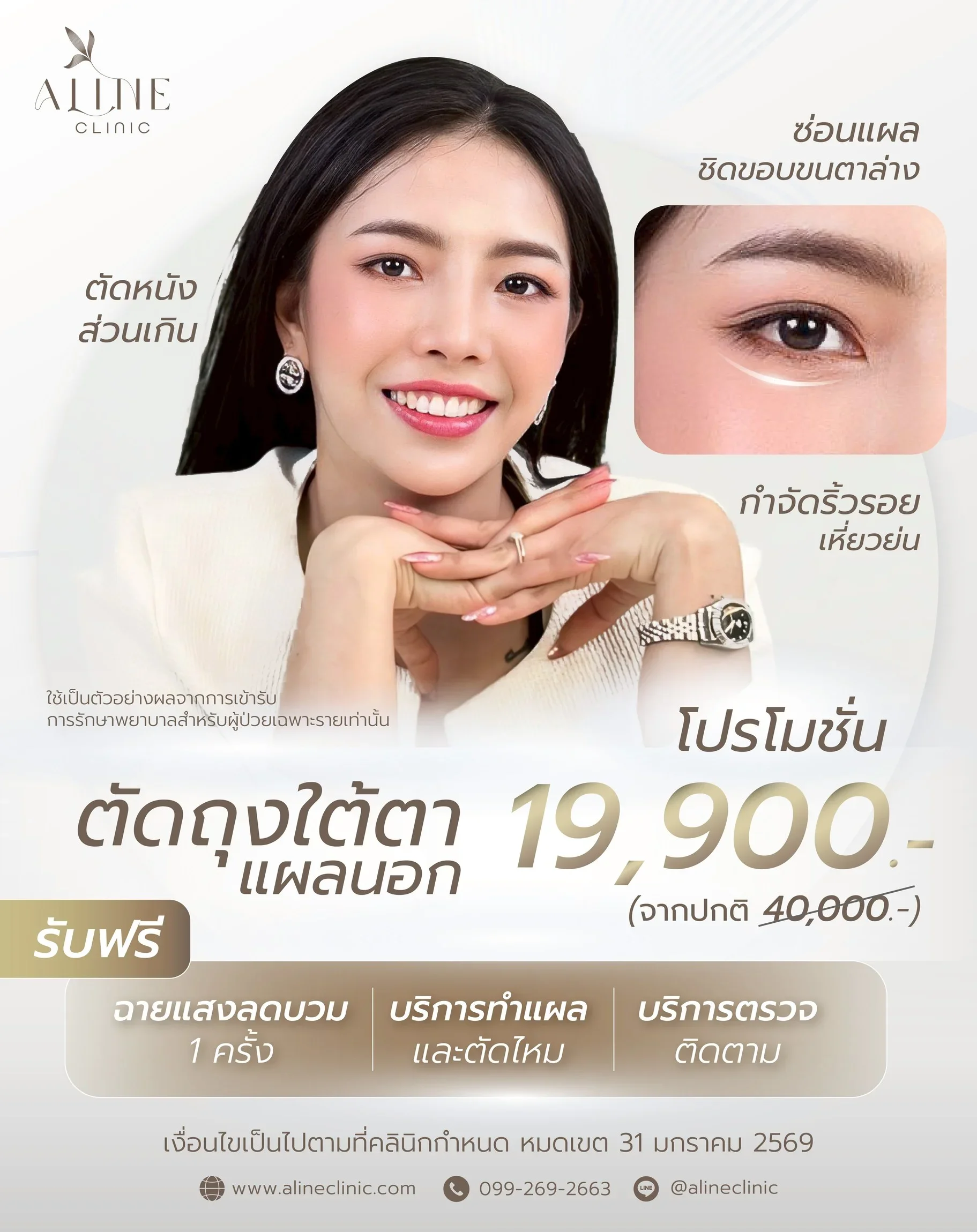 โปรโมชั่นตัดถุงใต้ตา