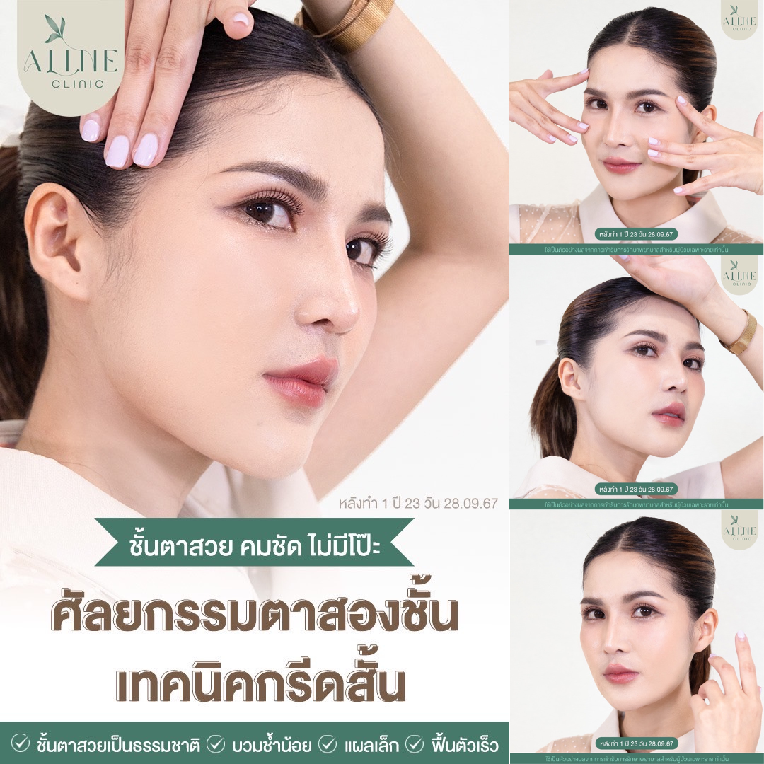 รีวิวตาสองชั้น รีวิวตาสองชั้น