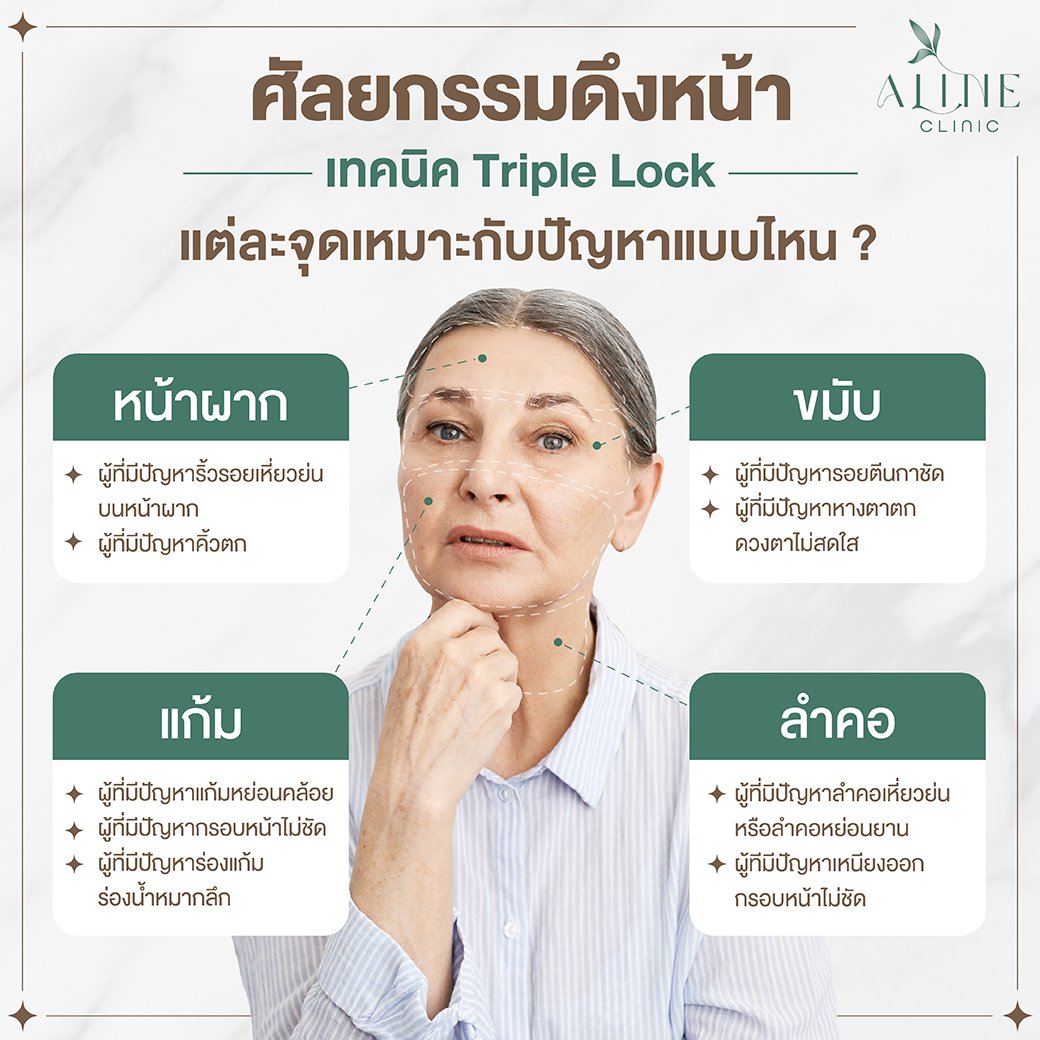 ดึงหน้าชั้นลึก smas
