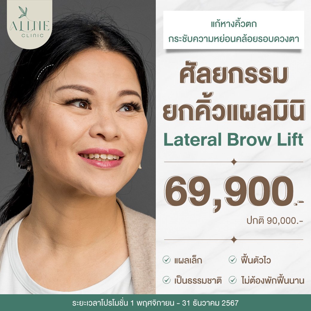 โปรโมชั่นยกคิ้ว