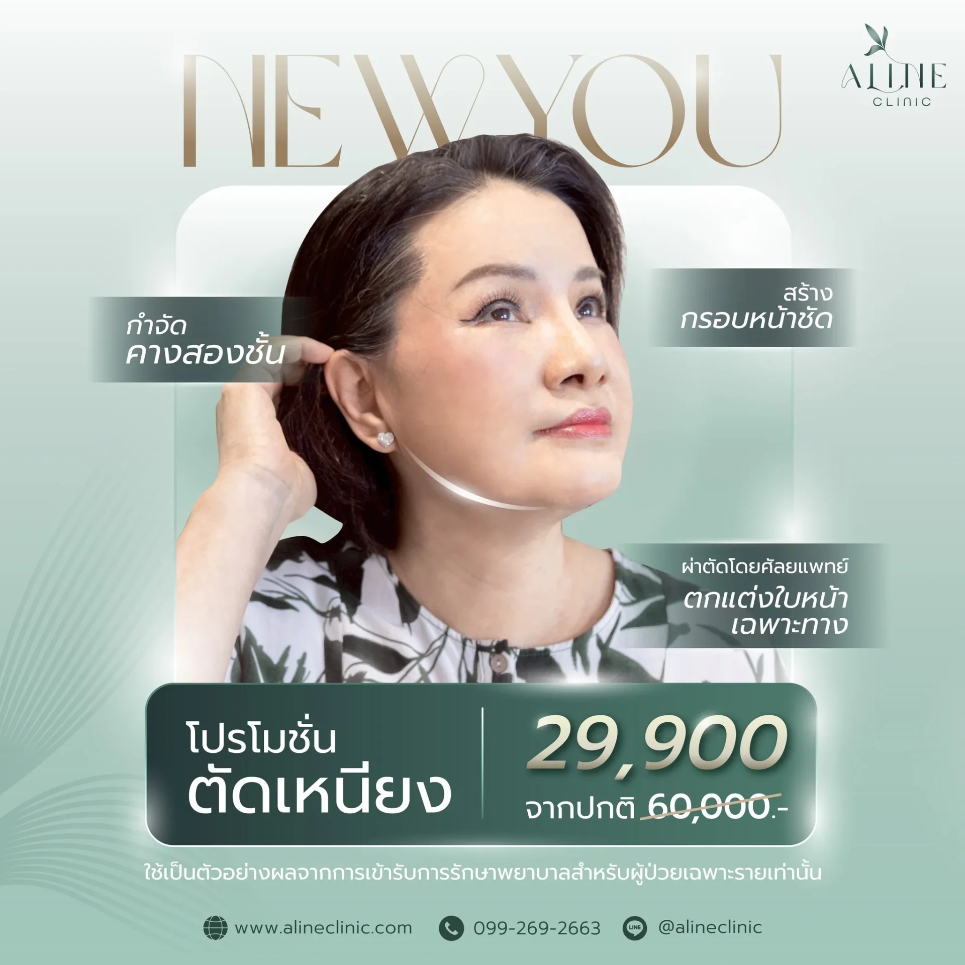 โปรโมชั่นตัดเหนียง