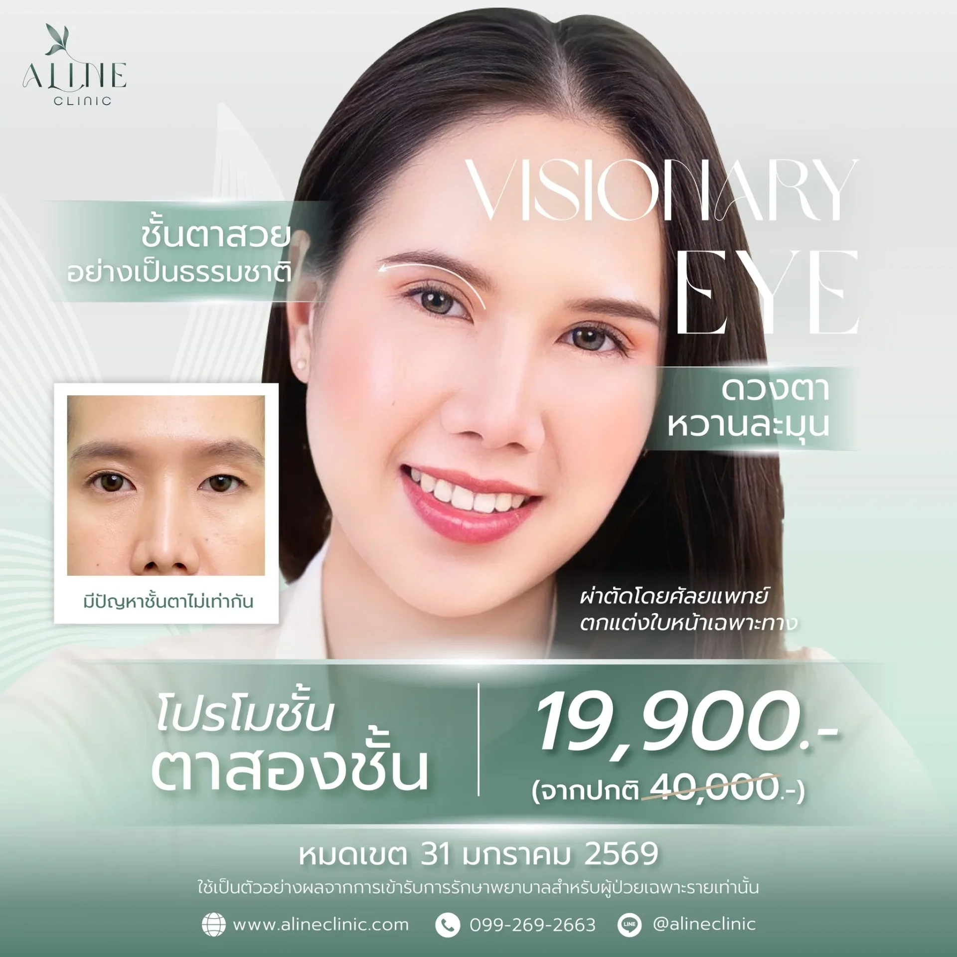 โปรโมชั่นตาสองชั้น