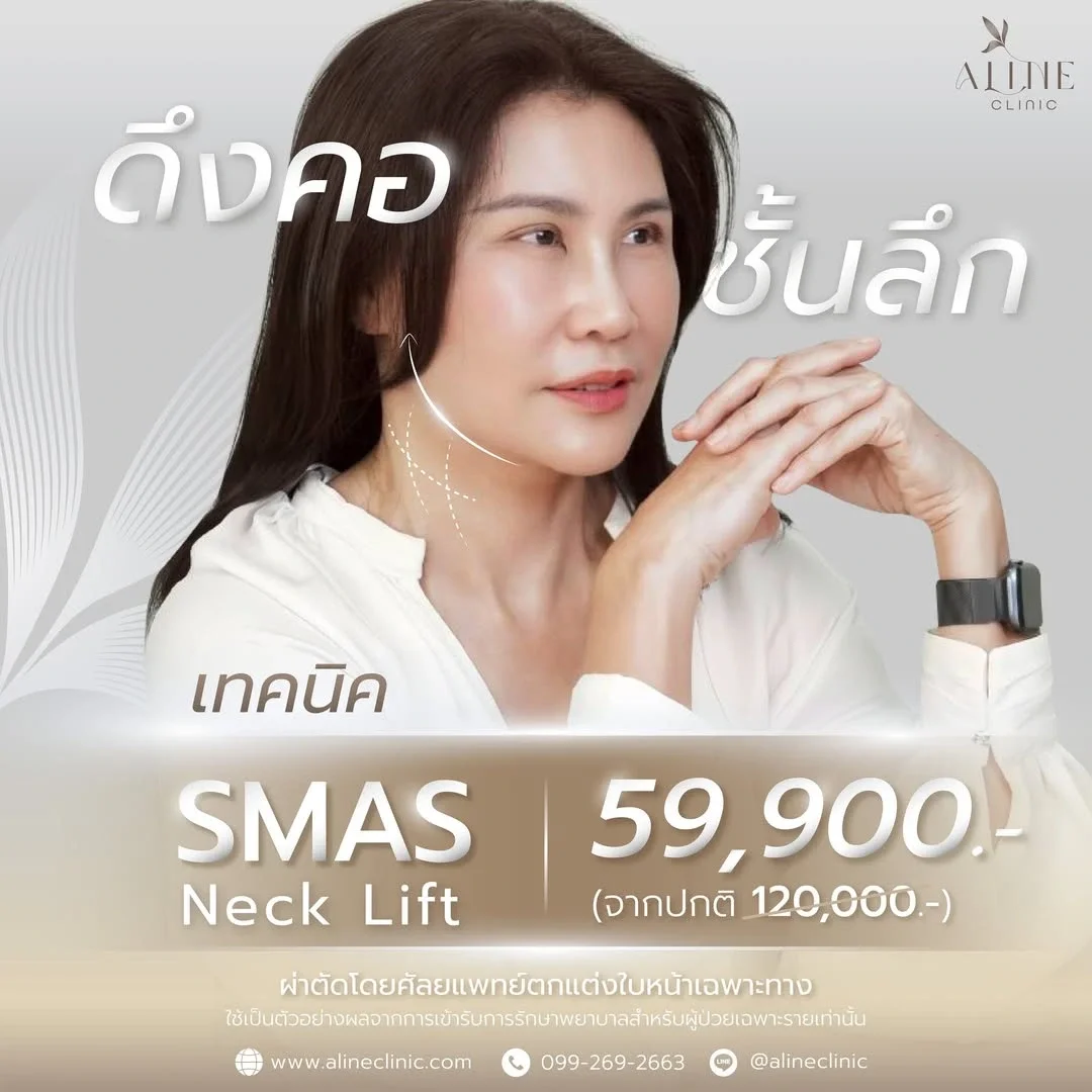 โปรโมชั่นดึงคอ