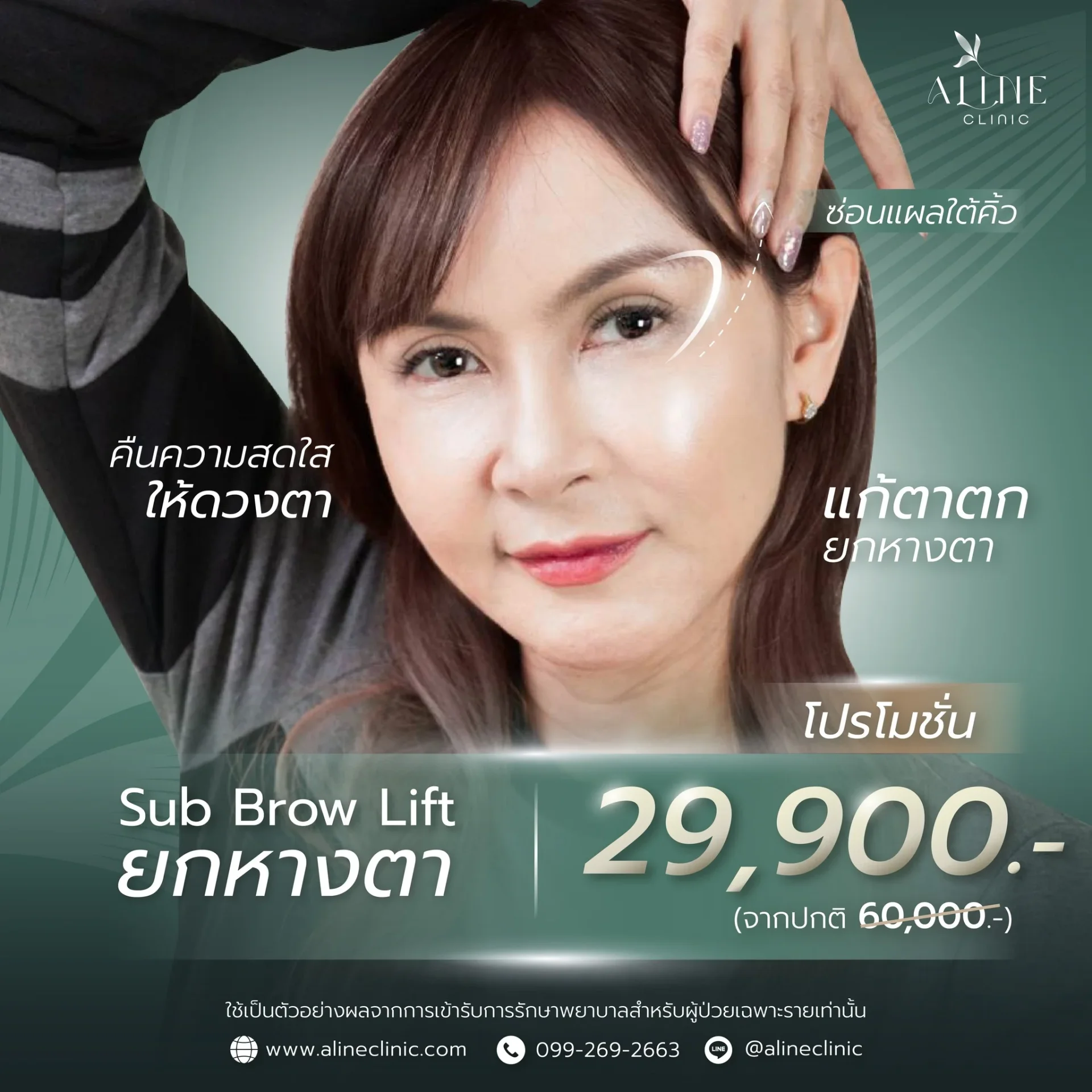 โปรโมชั่นยกหางตา