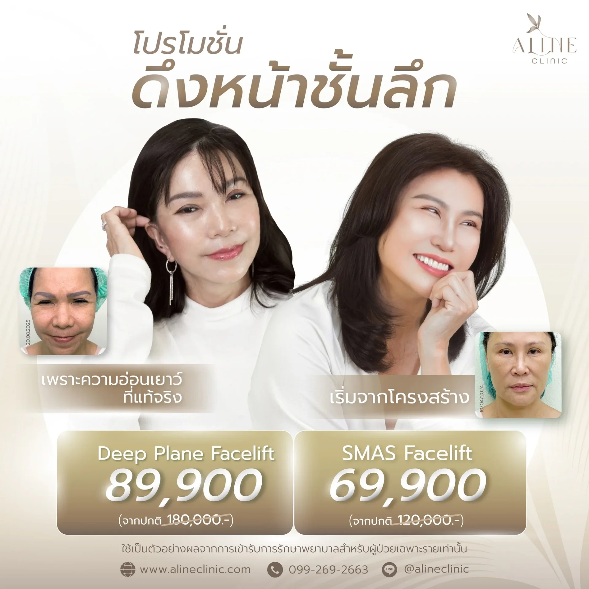 โปรโมชั่นดึงหน้า