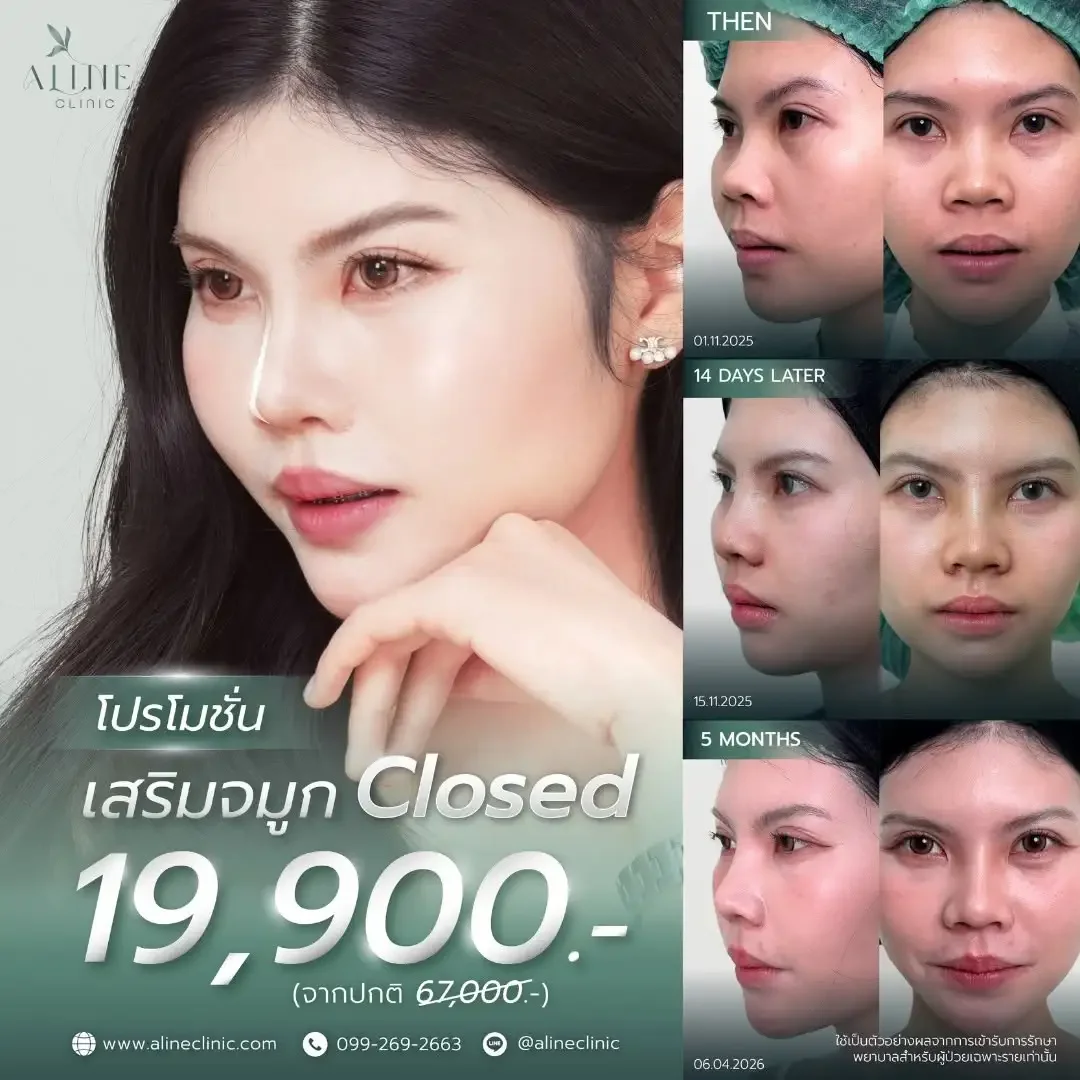 เสริมจมูก ราคา โคราช aline clinic