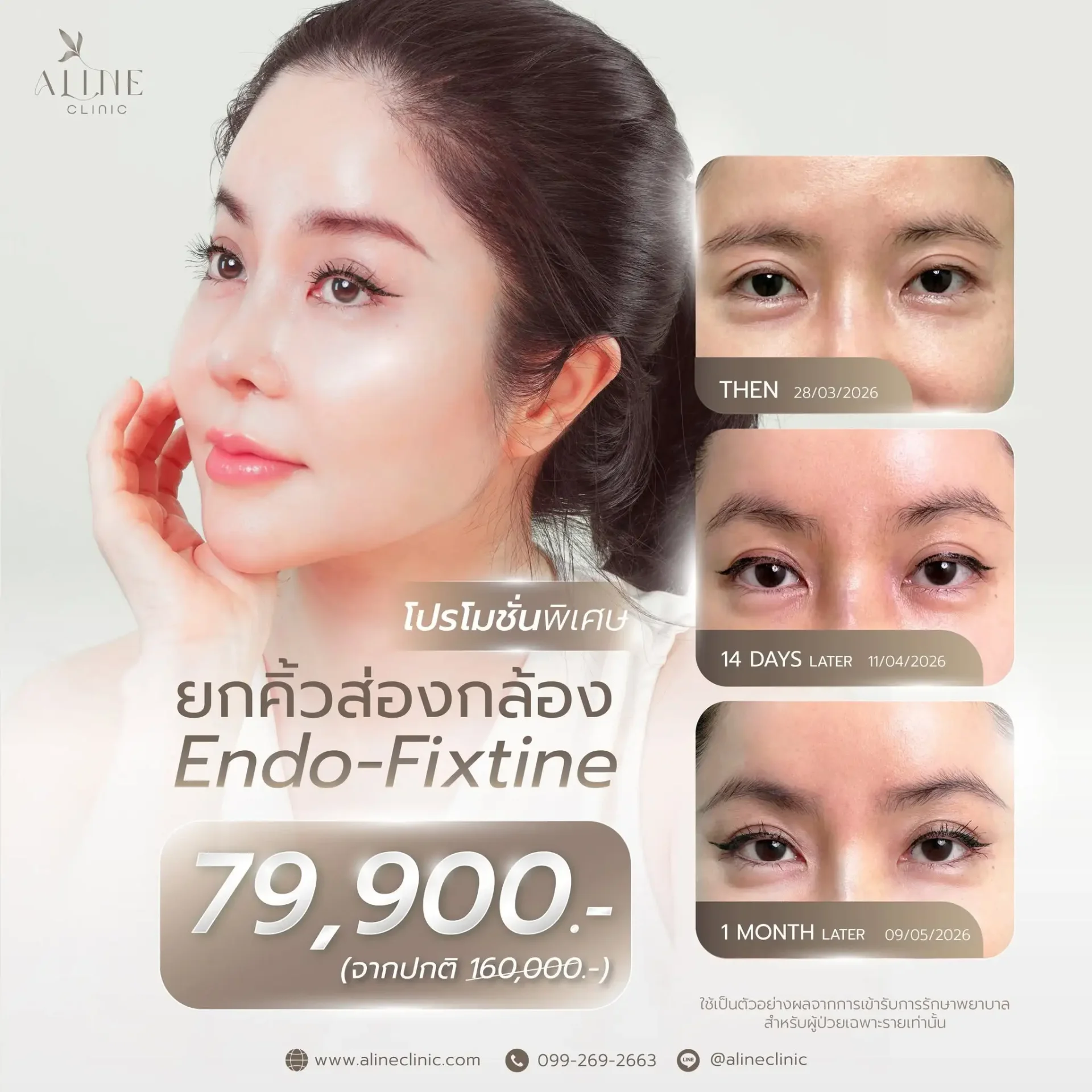 ยกคิ้วส่องกล้อง ราคา โคราช aline clinic
