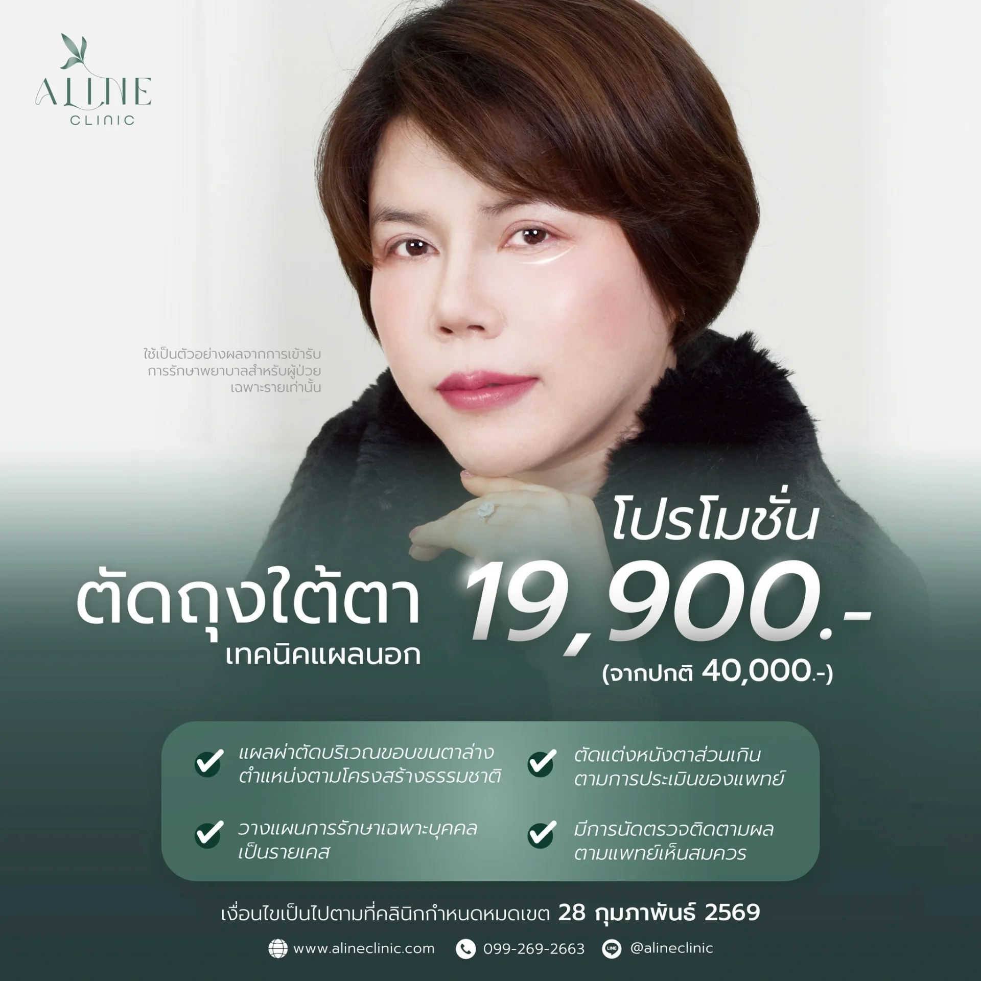 โปรโมชั่นตัดถุงใต้ตา