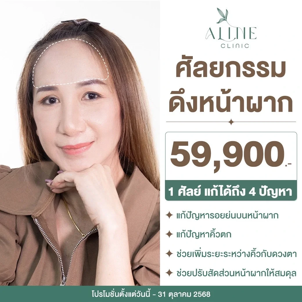 โปรโมชั่นดึงหน้า