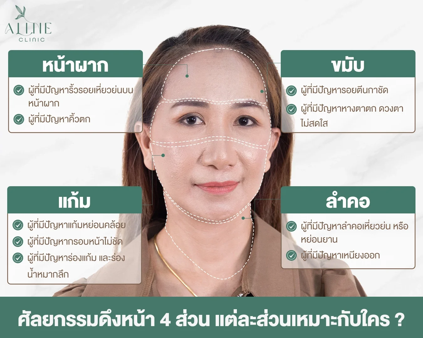 ดึงหน้า 4 ส่วน