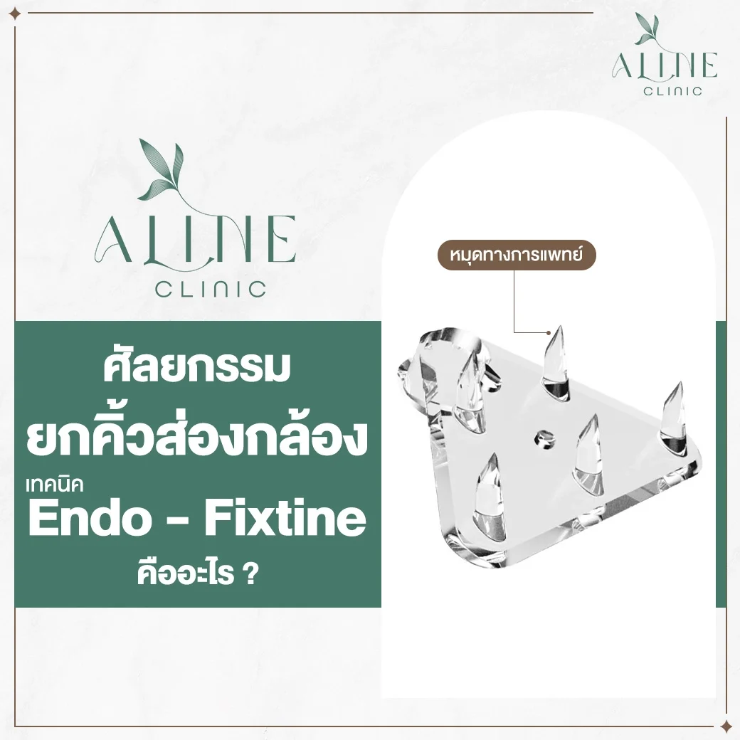 ยกคิ้วส่องกล้อง endotine