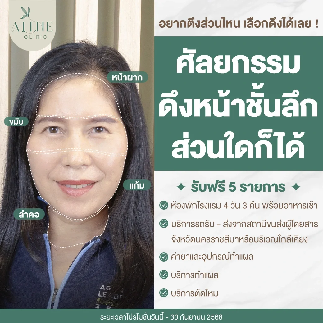 โปรโมชั่นดึงหน้า