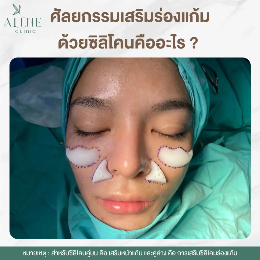 ศัลยกรรมเสริมร่องแก้ม โคราช