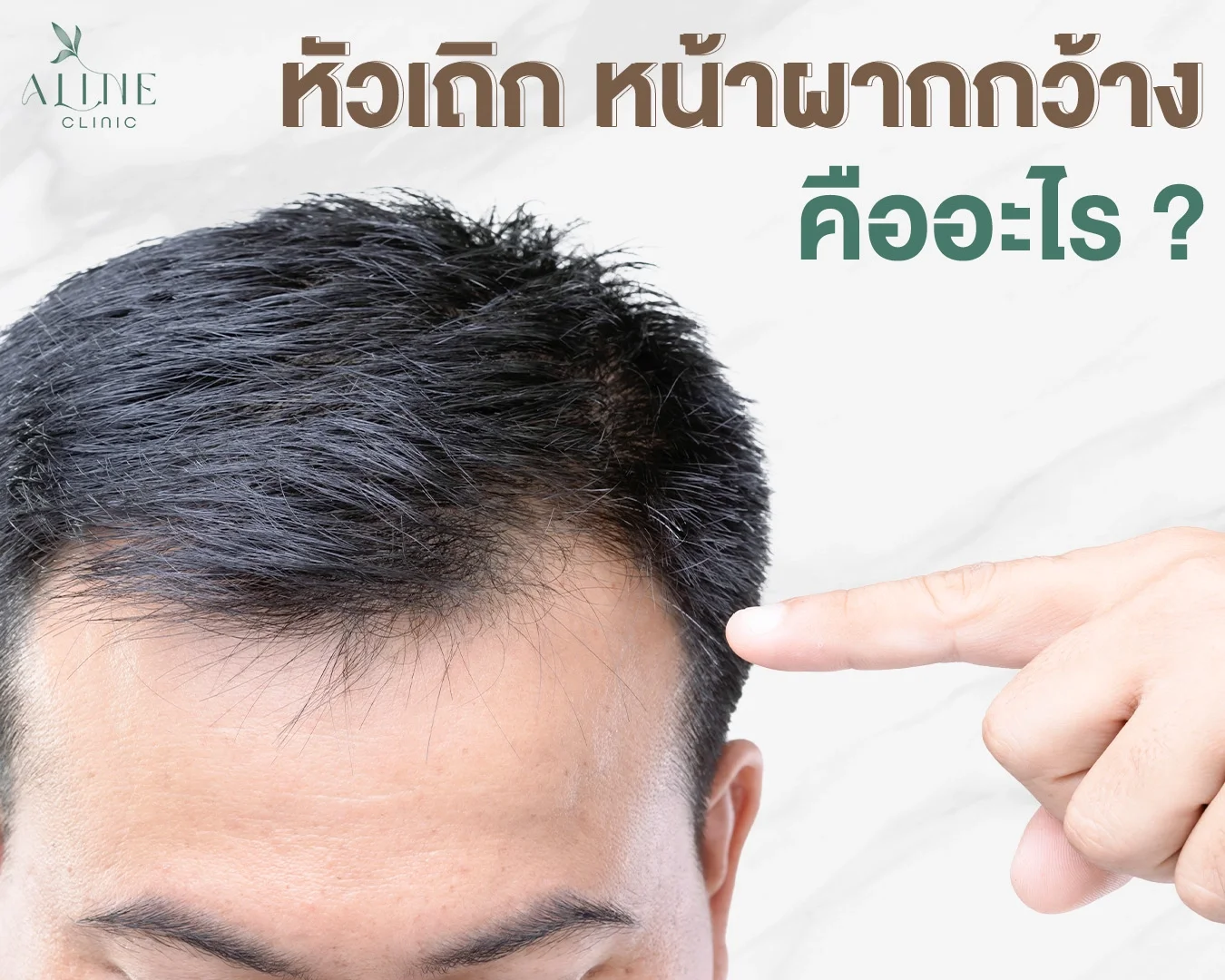 หัวเถิก หน้าผากกว้าง คืออะไร