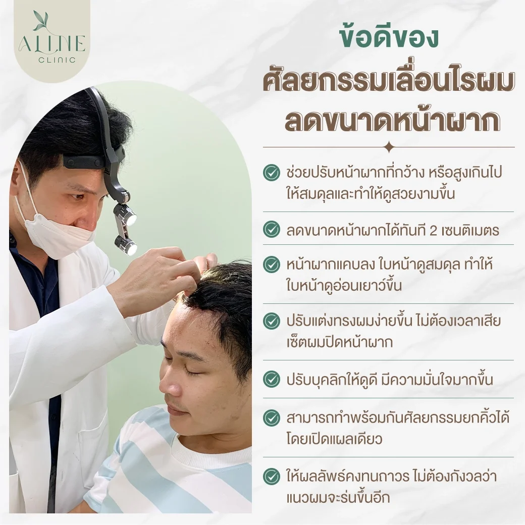 ข้อดีของศัลยกรรมเลื่อนไรผม ลดขนาดหน้าผาก
