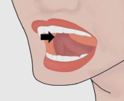 การออกกำลังกายช่องปากและคอหอย แก้นอนกรน