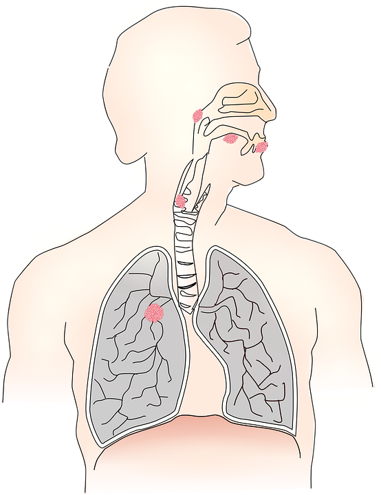 One-Year Outcomes and Health Care Utilization in Survivors of Severe Acute Respiratory Syndrome