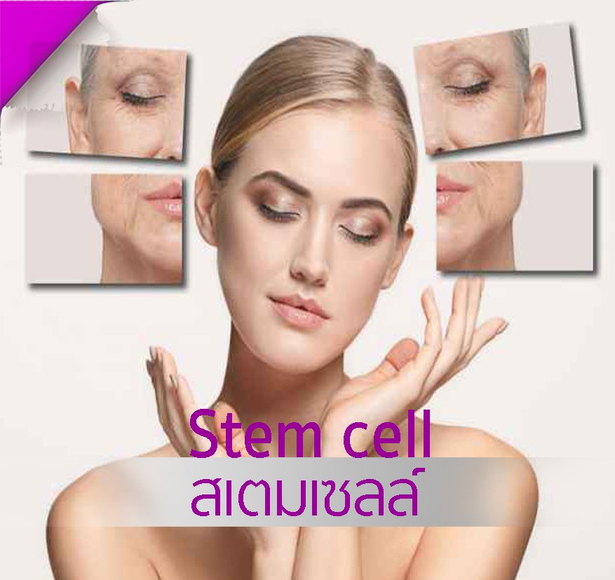 Stem cell