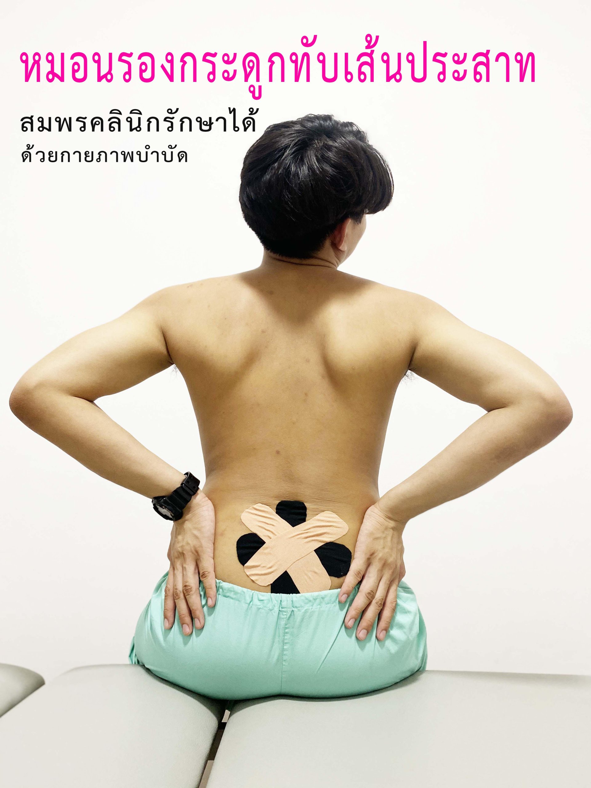หมอนรองกระดูกทับเส้นประสาท รักษาได้