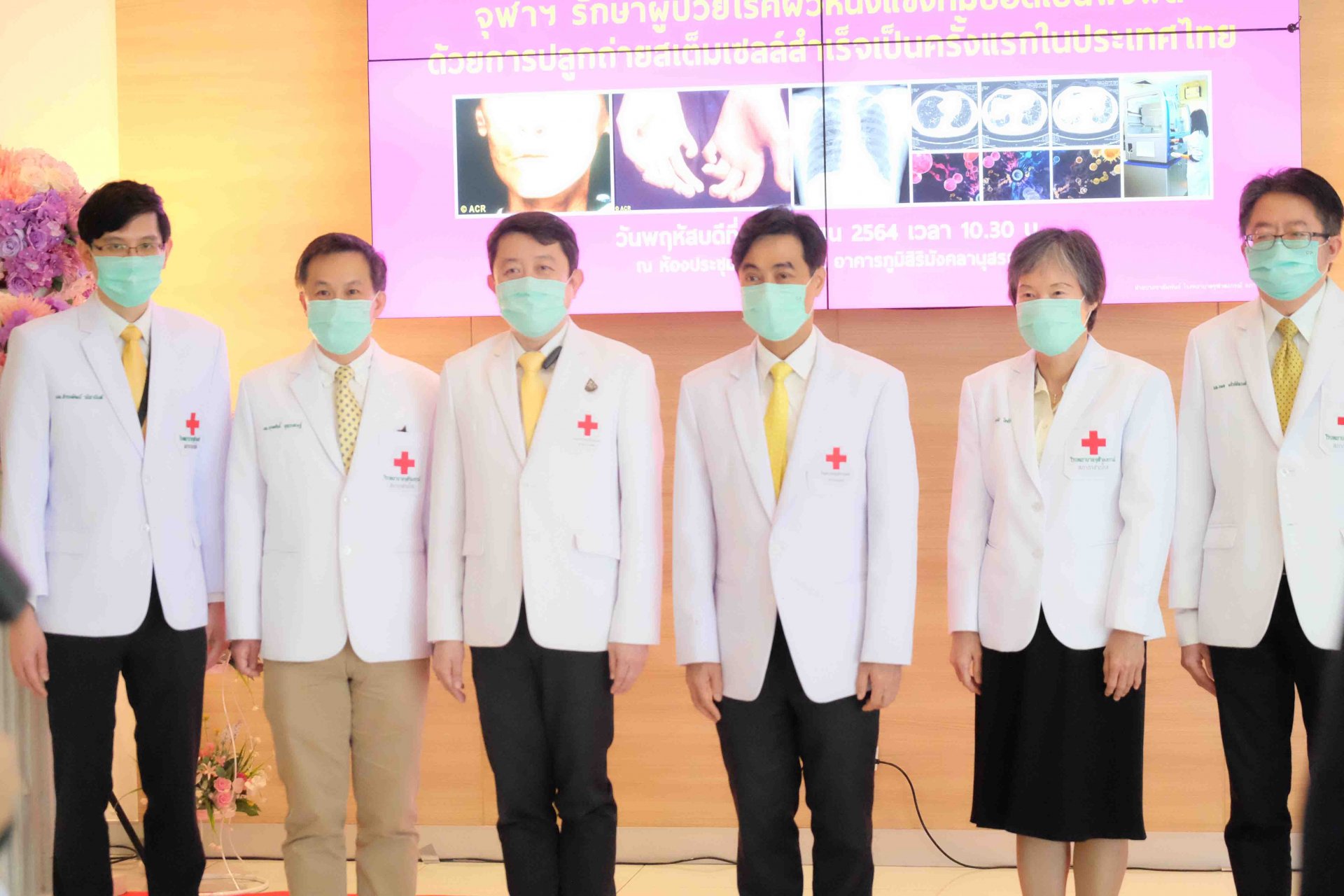 จุฬาฯ รักษาผู้ป่วยโรคผิวหนังแข็งที่มีปอดเป็นพังผืด ด้วยการปลูกถ่ายสเต็มเซลล์สำเร็จเป็นครั้งแรกในประเทศไทย