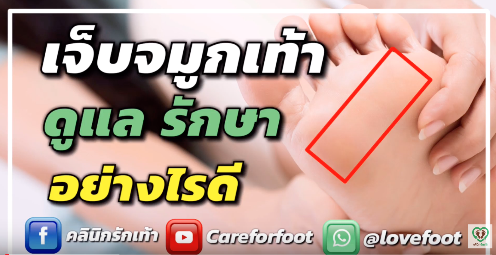 จมูกเท้าอักเสบ