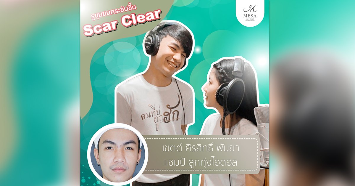 รักษาหลุมสิว กระชับรูขุมขน, รักษาหลุมสิว