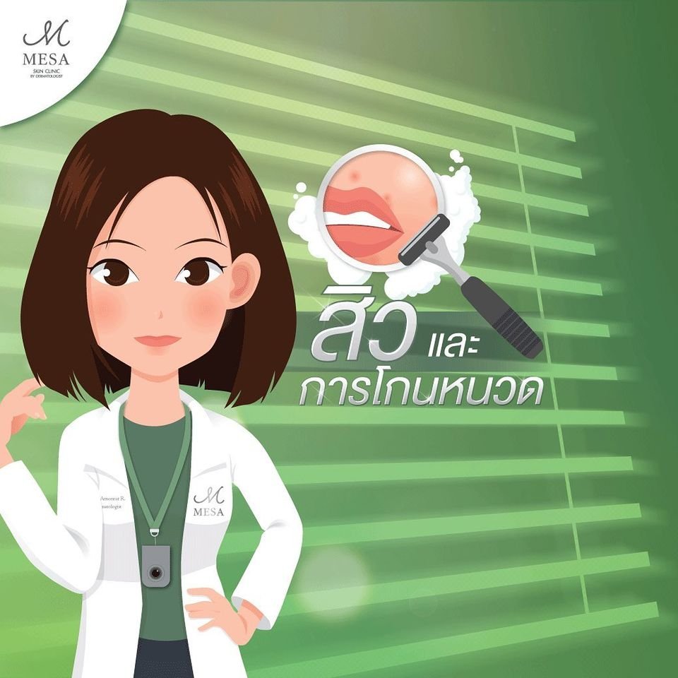 สิวและการโกนหนวด สิวและการโกนหนวด