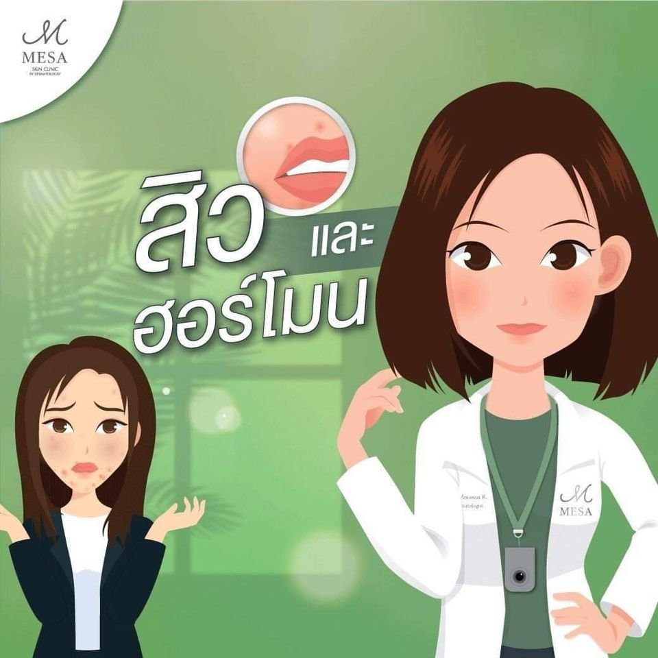 สิวกับฮอร์โมน