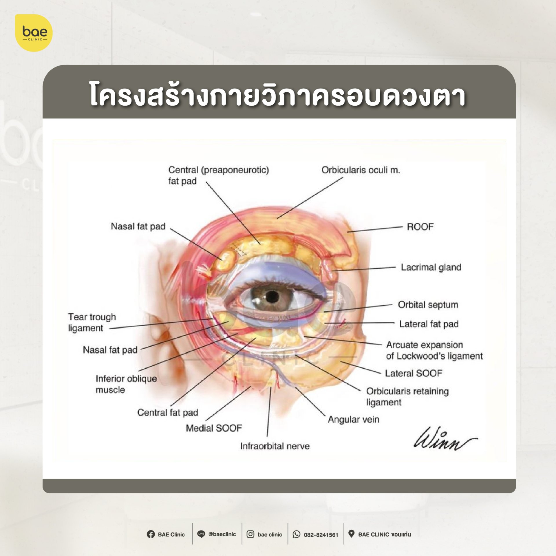 Filler ใต้ตา ,ฟิลเลอร์ใต้ตา ,ใต้ตาคล้ำ ,ใต้ตา ,โครงสร้างตา