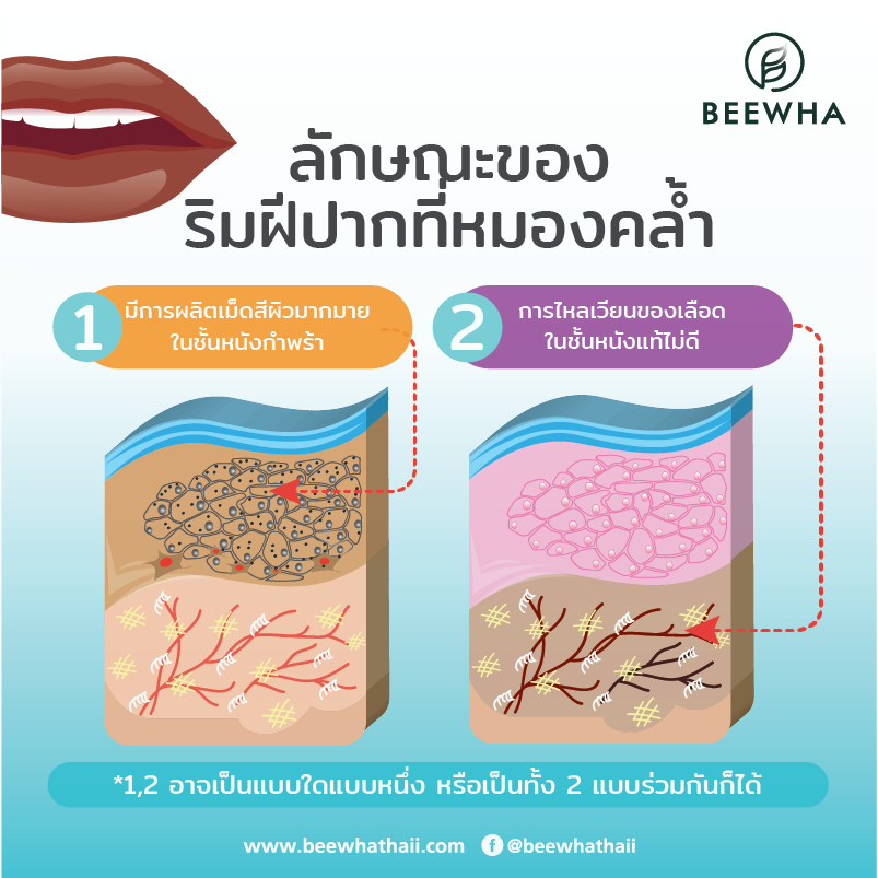 ลักษณะของริมฝีปากดำคล้ำไม่สดใส ลักษณะของริมฝีปากดำคล้ำไม่สดใส