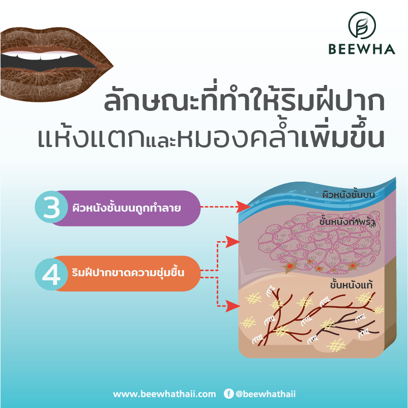 ลักษณะที่ทำให้ริมฝีปากแห้งแตกและหมองคล้ำเพิ่ม ลักษณะที่ทำให้ริมฝีปากแห้งแตกและหมองคล้ำเพิ่ม