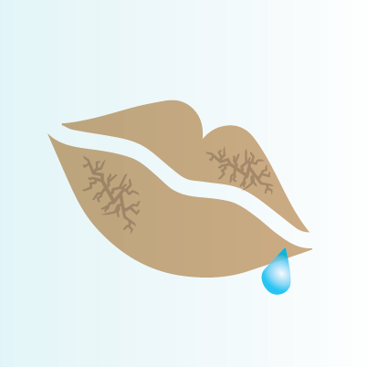 การเลียริมฝีปากทำให้ปากแตกแห้ง ดำคล้ำ การเลียริมฝีปากทำให้ปากแตกแห้ง ดำคล้ำ