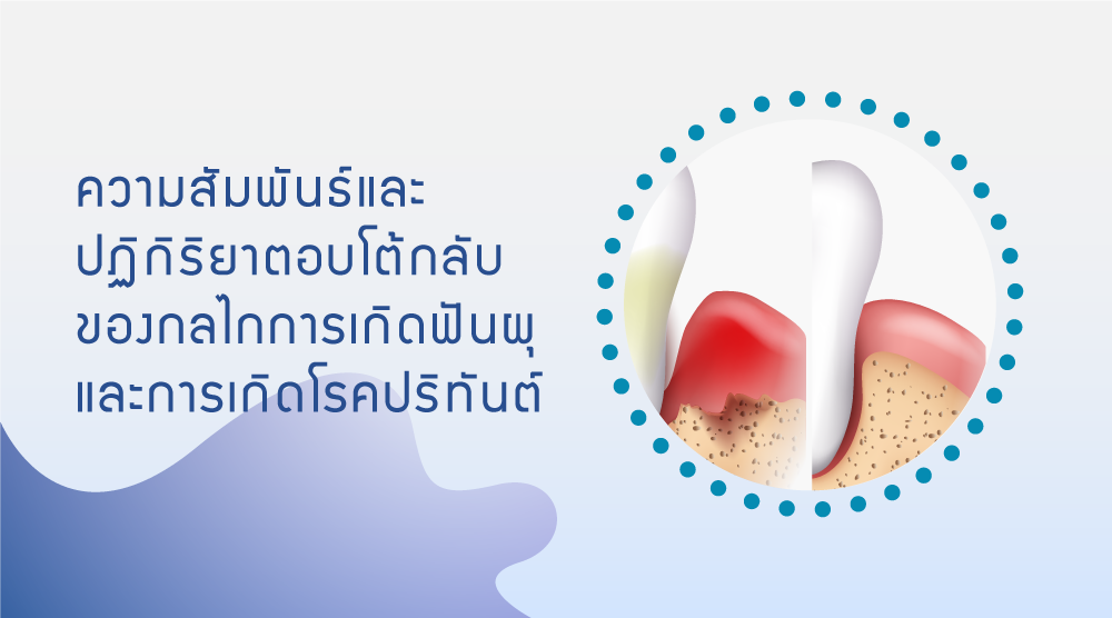 ความสัมพันธ์และปฏิกิริยาตอบโต้กลับของกลไกการเกิดฟันผุและกลไกการเกิดโรคปริทันต์ 