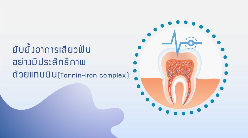 ยับยั้งอาการเสียวฟันอย่างมีประสิทธิภาพด้วย Tannic acid–iron(III) [TA/Fe3+]