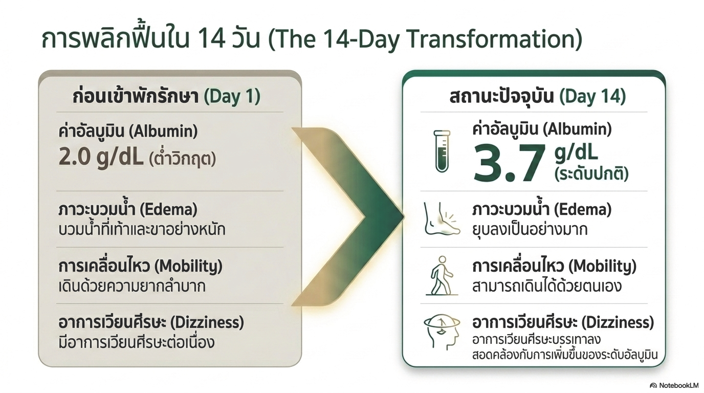 สไลด์ที่ 4: การพลิกฟื้นใน 14 วัน The 14-Day Transformation เปรียบเทียบสภาพก่อนเข้าพักรักษา Day 1 กับสถานะปัจจุบัน Day 14 ด้านอัลบูมินเพิ่มจาก 2.0 g/dL วิกฤต เป็น 3.7 g/dL ระดับปกติ ด้านบวมน้ำ Edema ยุบลงเป็นอย่างมากจากบวมน้ำที่เท้าและขาหนักมาก ด้านการเคลื่อนไหว Mobility จากเดินด้วยความยากลำบากเป็นสามารถเดินได้ด้วยตนเอง และด้านอาการเวียนศีรษะ Dizziness บรรเทาลงสอดคล้องกับการเพิ่มขึ้นของระดับอัลบูมิน