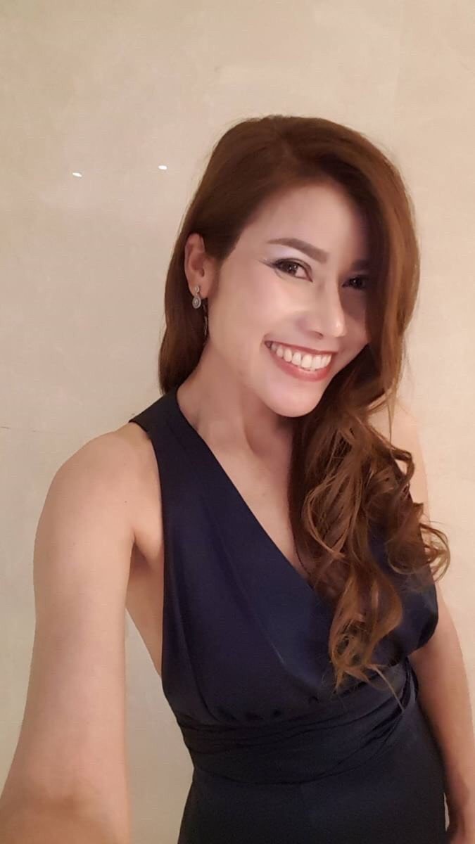 "ร้อยไหมหน้าเด็ก,ร้อยไหมรอบดวงตา+ปลายตา" กับคุณหมอไก่ 	ประสบการณ์ตรงของ คุณไม้ อายุ 48 ปี จาก ขอนแก่น