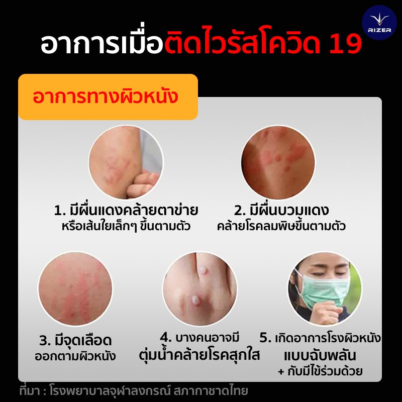 ไวรัสโควิด 19 (COVID 19) ไวรัสโควิด 19 (COVID 19)