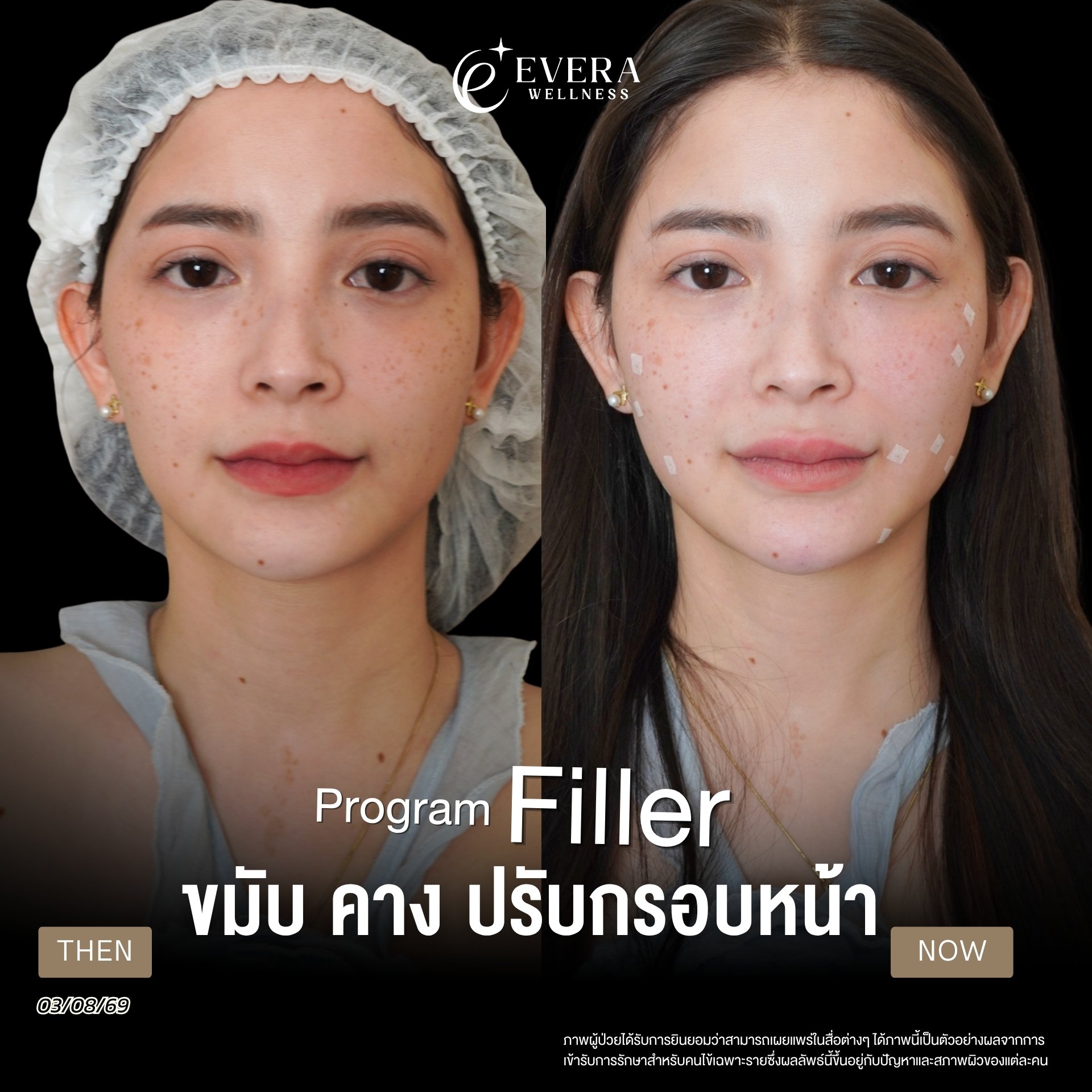 ภาพรีวิวโปรแกรม Filler ที่ผู้ใช้ส่ง พร้อมวันที่และข้อความกำกับ