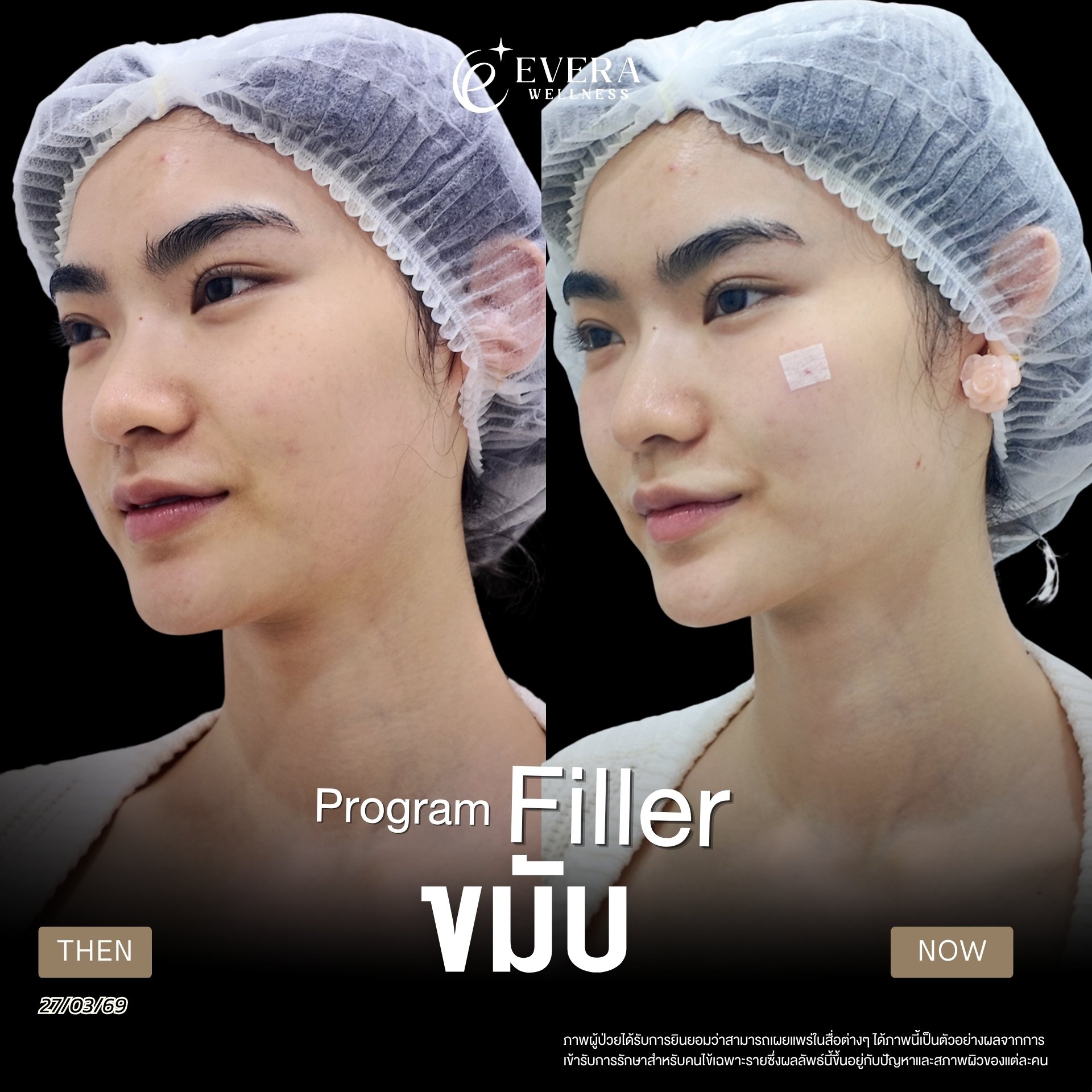 ภาพรีวิวโปรแกรม Filler ที่ผู้ใช้ส่ง รูปที่ 3 พร้อมวันที่และข้อความกำกับ