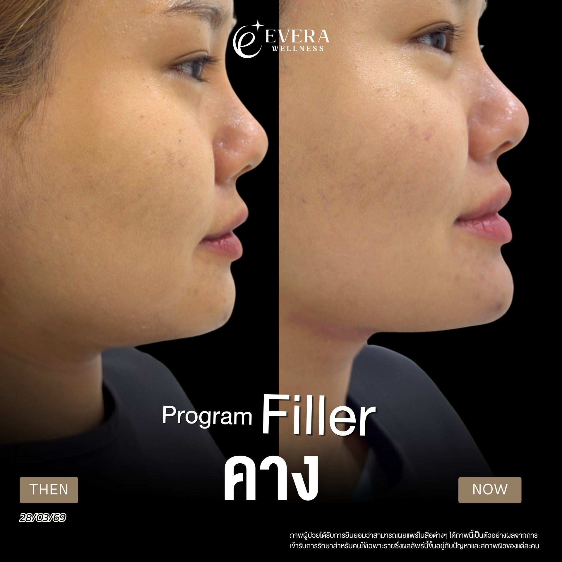 ภาพรีวิวโปรแกรม Filler ที่ผู้ใช้ส่ง รูปที่ 4 พร้อมวันที่และข้อความกำกับ