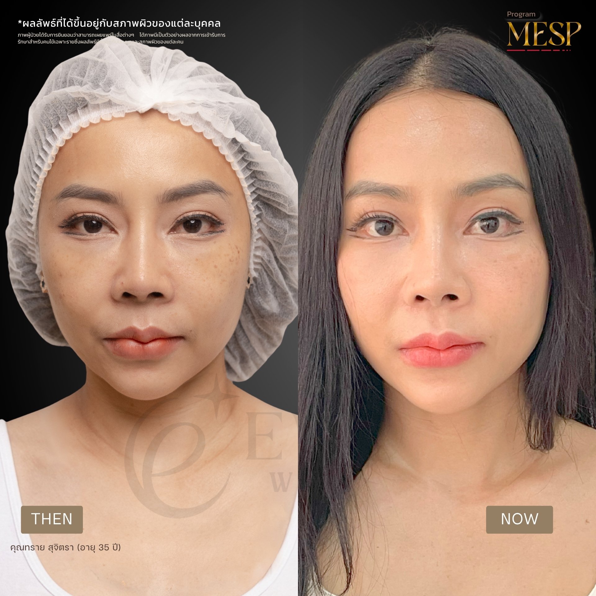 ภาพรีวิวโปรแกรม MESP ที่ผู้ใช้ส่ง รูปที่ 2 พร้อมข้อความกำกับ