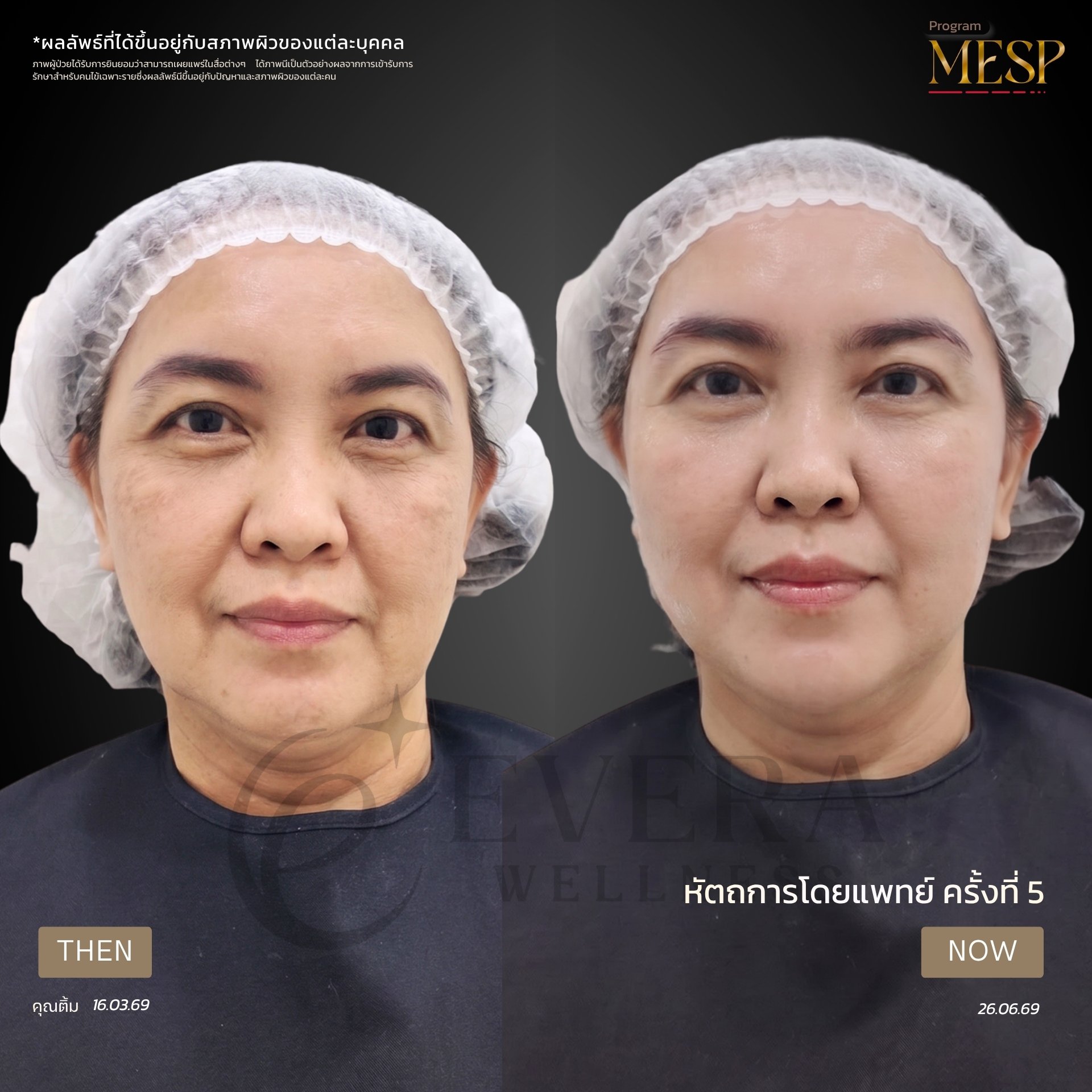 ภาพรีวิวโปรแกรม MESP ที่ผู้ใช้ส่ง รูปที่ 3 พร้อมข้อความกำกับ