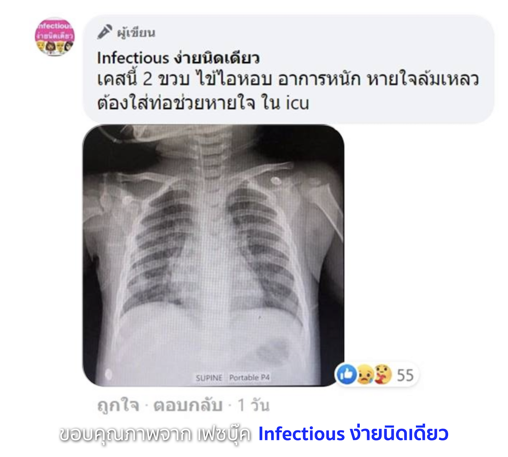 RSV เด็กอาการหนัก อย่าหาว่านูสอนใช้ประกัน EP.11 RSV เด็กอาการหนัก อย่าหาว่านูสอนใช้ประกัน EP.11