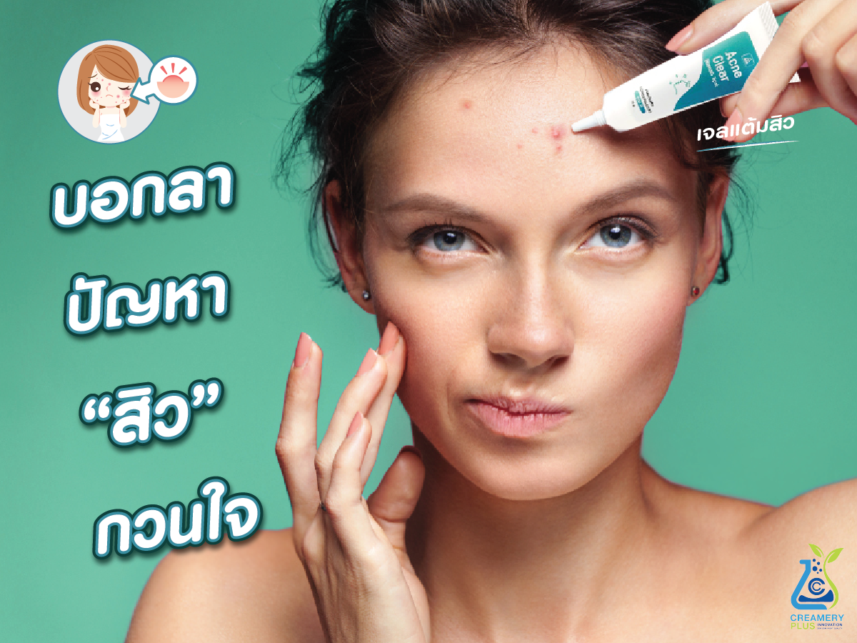 บอกลา ปัญหา “สิว” กวนใจ