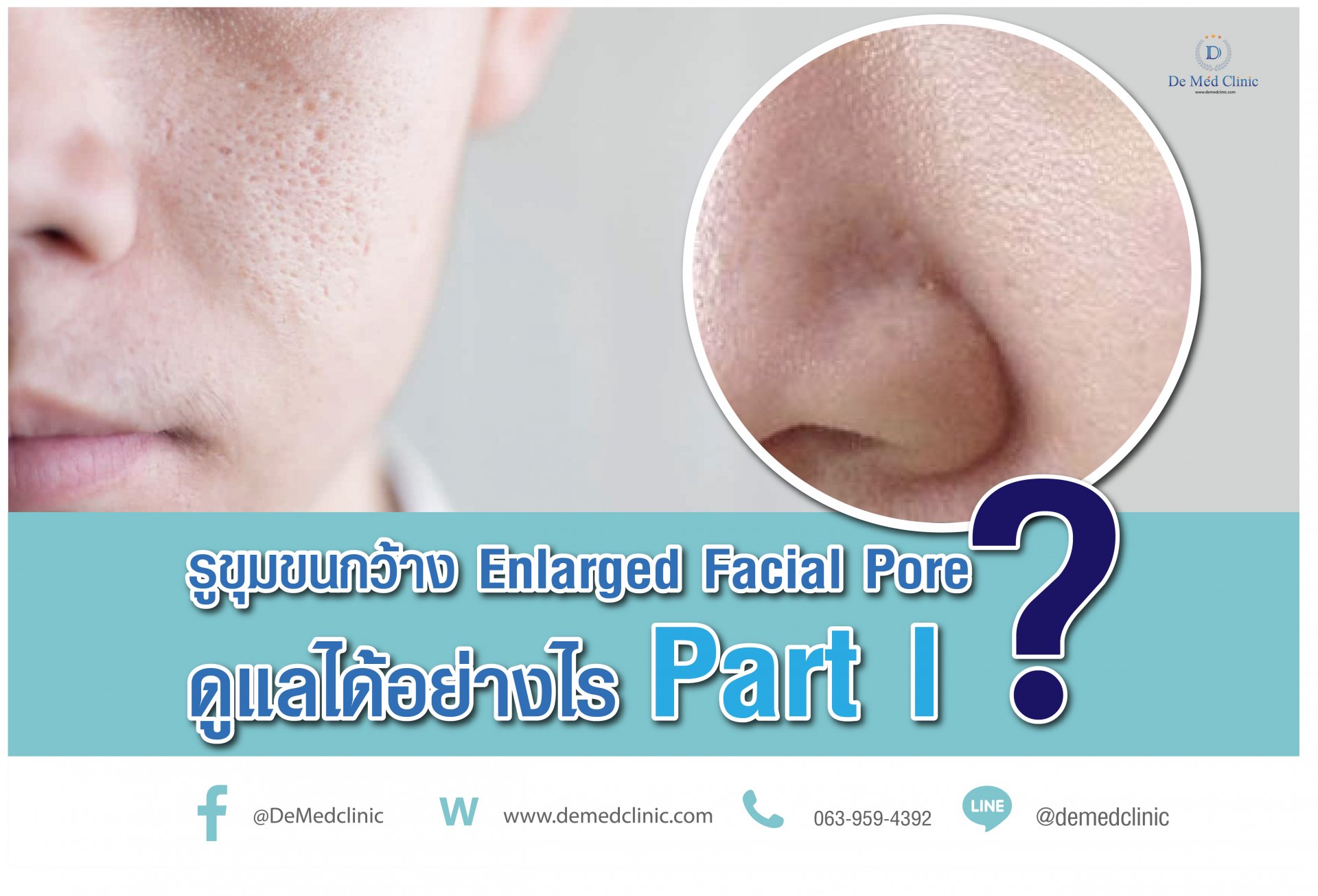 รูขุมขนกว้าง Enlarged facial Pore เกิดจากอะไรดูแลได้อย่างไร Part I ?